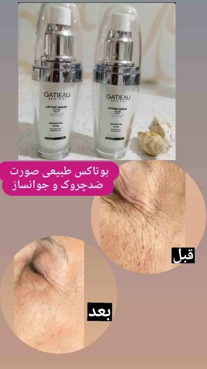 سرم لیفت کننده گاتیو